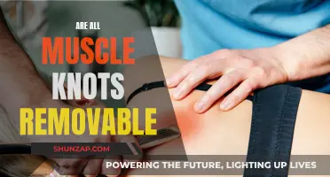 Muscle Knots: Can They All Be Removed?