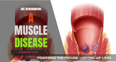 Hemorrhoids: A Muscle Disease or Something Else?