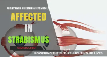 Understanding Strabismus: Impact on Intrinsic vs. Extrinsic Eye Muscles