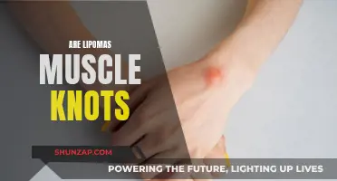 Lipomas and Muscle Knots: What's the Difference?