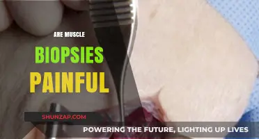 Are Muscle Biopsies Painful? What to Expect During the Procedure