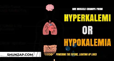 Understanding Muscle Cramps: Hyperkalemia vs. Hypokalemia