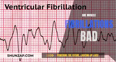 Muscle Fibrillations: What You Need to Know About These Twitchy Signals