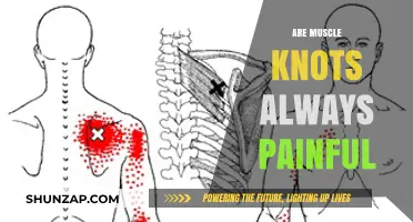 Are Muscle Knots Always Painful? Unraveling the Truth Behind Trigger Points