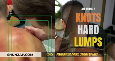 Muscle Knots: Hard Lumps or Something Else?