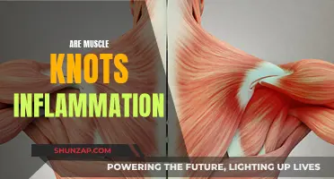 Muscle Knots: Inflammation or Something Else?