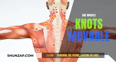 What Are Muscle Knots? Are They Movable?