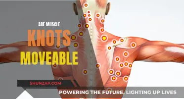 Muscle Knots: Are They Migratory or Stationary?