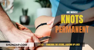 Muscle Knots: Understanding Their Persistence and Treatment Options