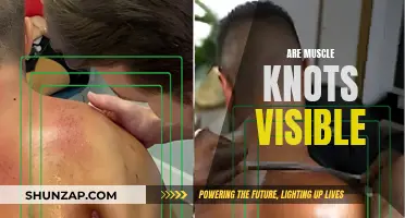 What Muscle Knots Look Like: Visible or Not?