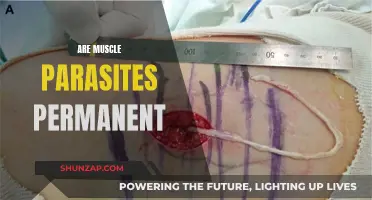 Muscle Parasites: A Permanent Problem or Temporary Nuisance?