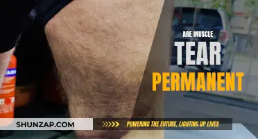 Muscle Tears: Healing and Permanent Damage Explained