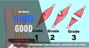 Are Muscle Tears Beneficial for Strength and Recovery?