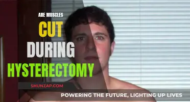 Hysterectomy: Muscle Incision and Recovery