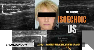 Muscle Ultrasound: Understanding the Isoechoic Appearance