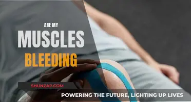 Understanding Rhabdomyolysis: Are My Muscles Bleeding?