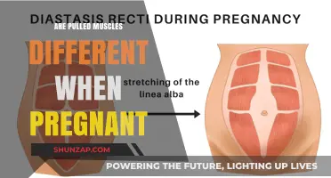Pregnancy and Pulled Muscles: Understanding Unique Risks and Recovery