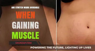 Can You Prevent Stretch Marks While Building Muscle? Expert Tips