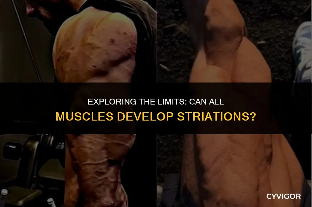 are there muscles that cant get striations