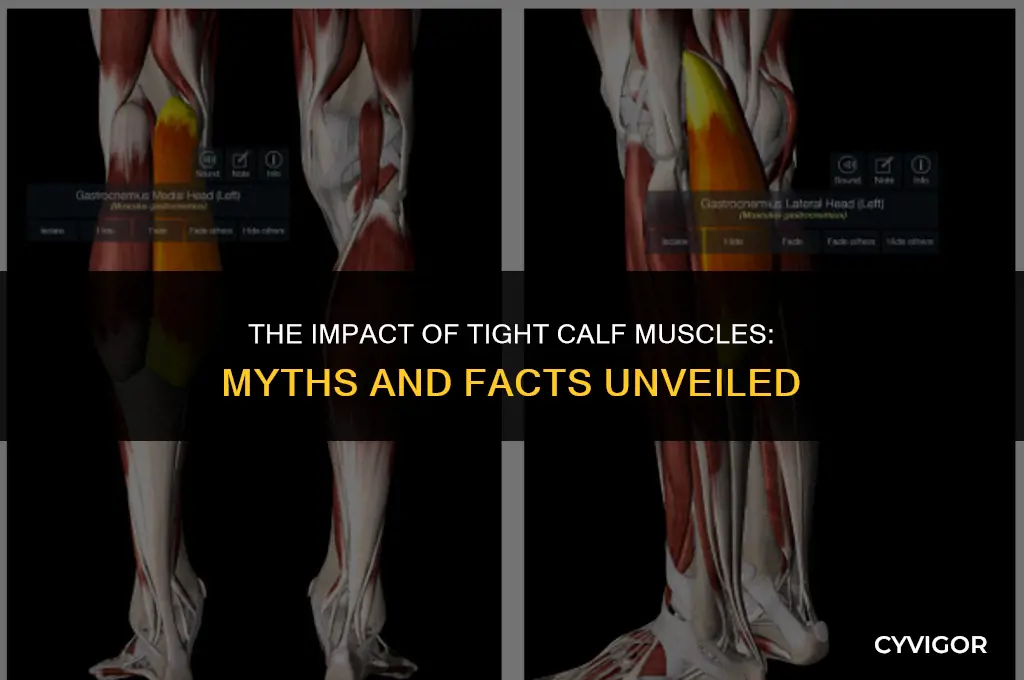 are tight calf muscles bad