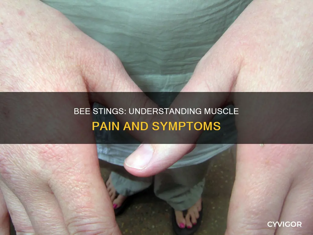 can a bee sting cause muscle pain