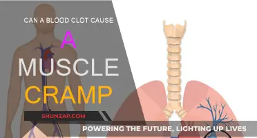 Blood Clots and Muscle Cramps: What's the Link?