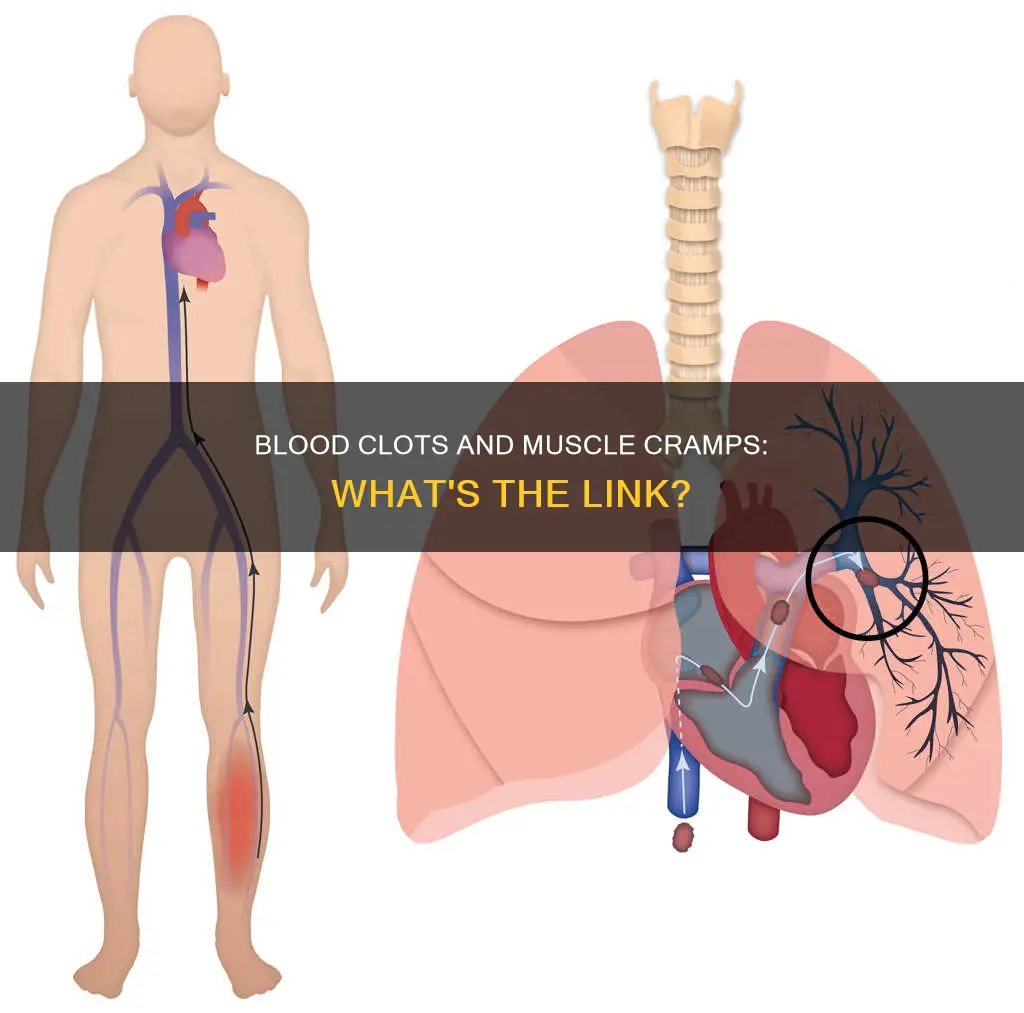 can a blood clot cause a muscle cramp