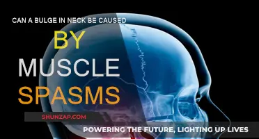 Neck Bulges: Muscle Spasms or Something More?