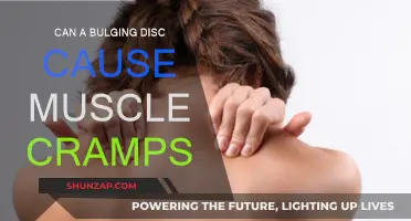 Bulging Discs: The Cause of Muscle Cramps?