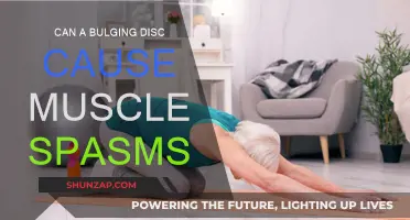 Bulging Discs: The Cause of Your Muscle Spasms?