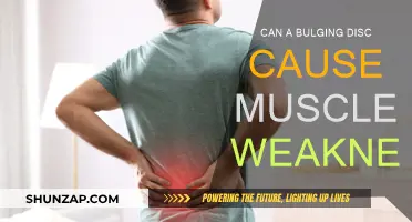 Bulging Discs: Muscle Weakness and Other Symptoms