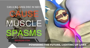 Bulging Discs and Muscle Spasms: What's the Link?
