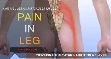 Bulging Disk: Leg Muscle Pain Cause?