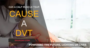 Calf Muscle Tears: A Surprising DVT Risk Factor?