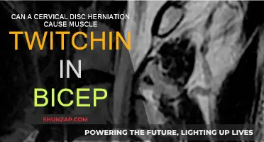 Cervical Disc Herniation: Bicep Twitching Explained