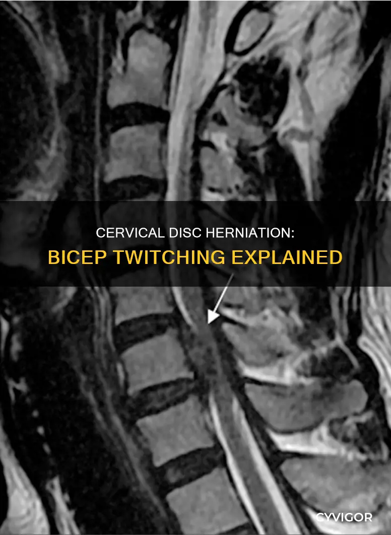 can a cervical disc herniation cause muscle twitching in bicep