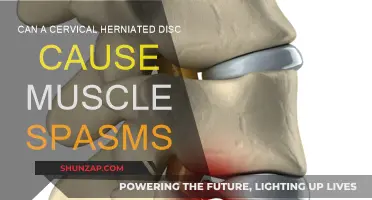 Cervical Herniated Disc: Muscle Spasms and Treatment