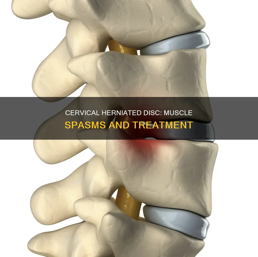 can a cervical herniated disc cause muscle spasms