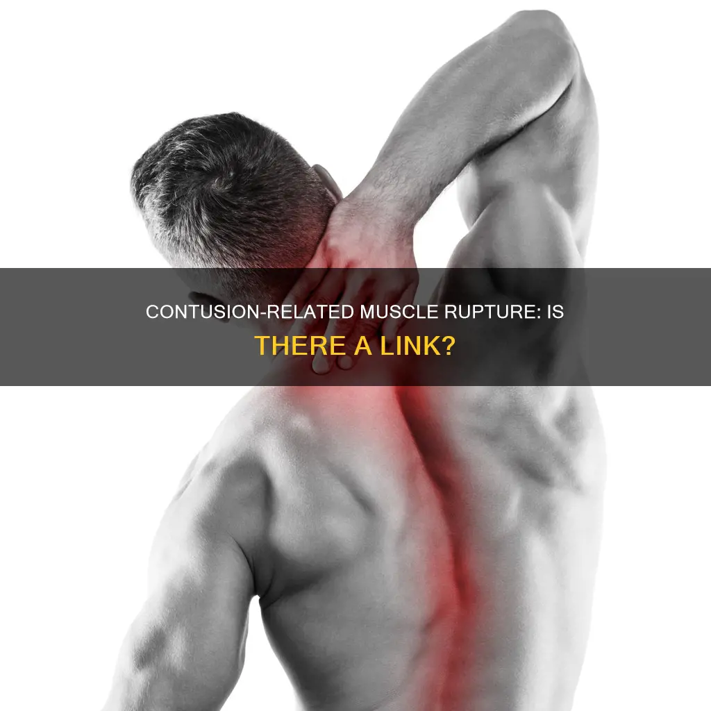 can a contusion cause a muscle rupture