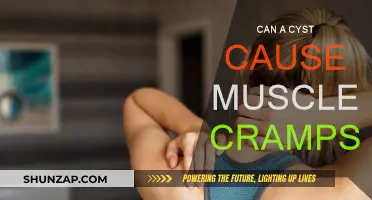 Cysts and Muscle Cramps: What's the Link?