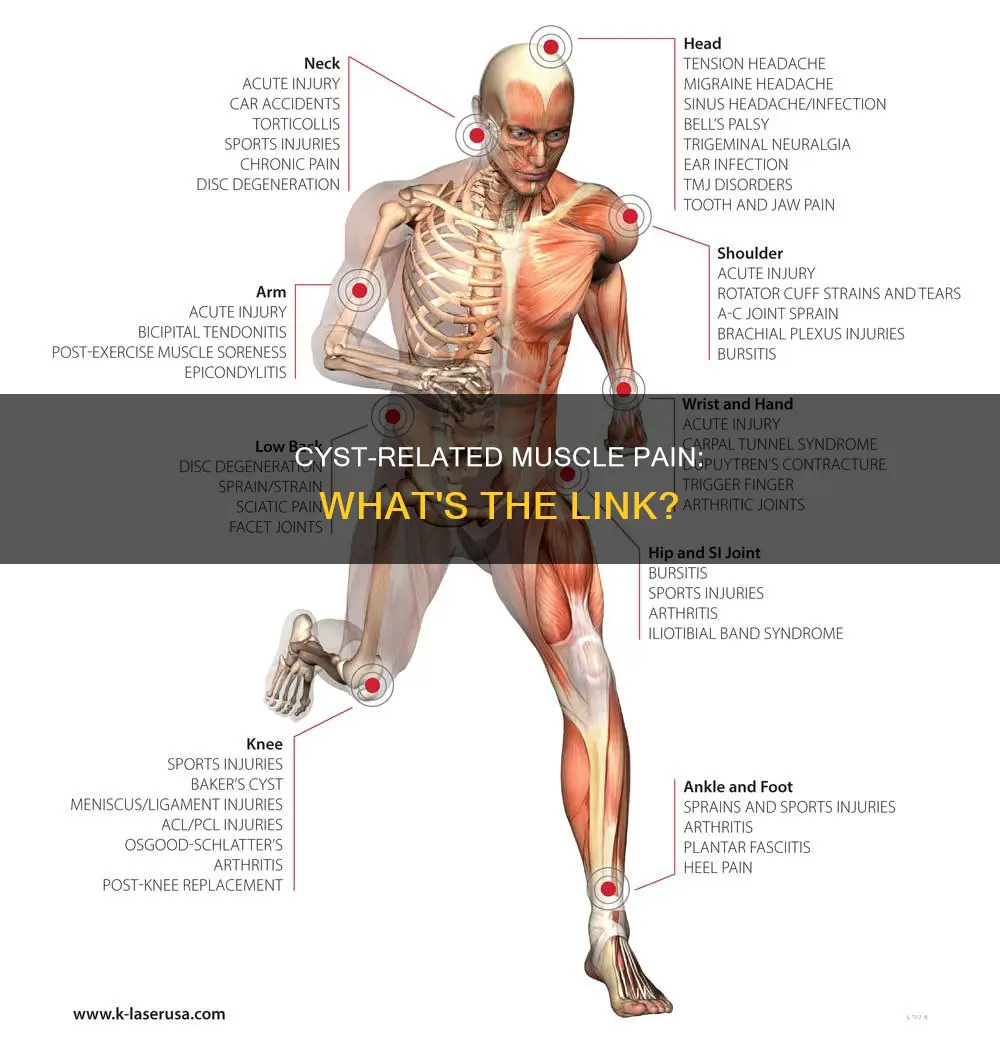 can a cyst cause muscle pain