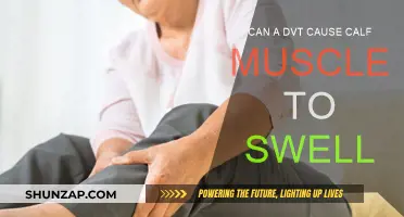 DVT and Calf Swelling: What's the Connection?