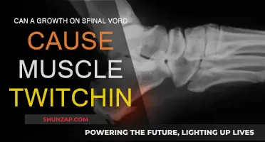 Spinal Growths: Do They Cause Muscle Twitching?