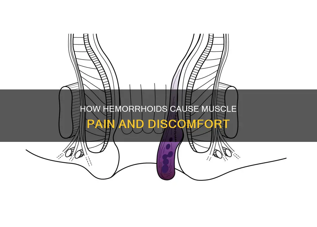 can a hemorrhoid cause other muscles to hurt