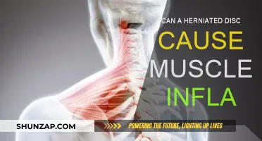 Herniated Disc: Muscle Inflammation and Pain