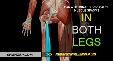 Herniated Discs: Leg Muscle Spasms Explained