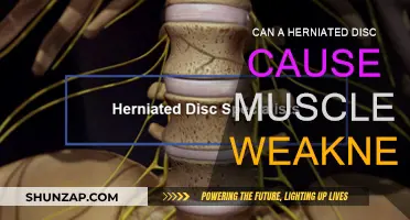 Herniated Discs: Muscle Weakness and Other Symptoms