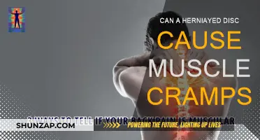 Herniated Discs: The Cause of Muscle Cramps?
