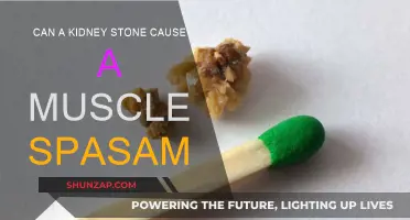 Kidney Stone Muscle Spasms: What's the Link?