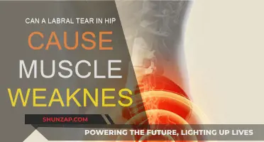 Labral Tear Impact: Hip Muscle Weakness?
